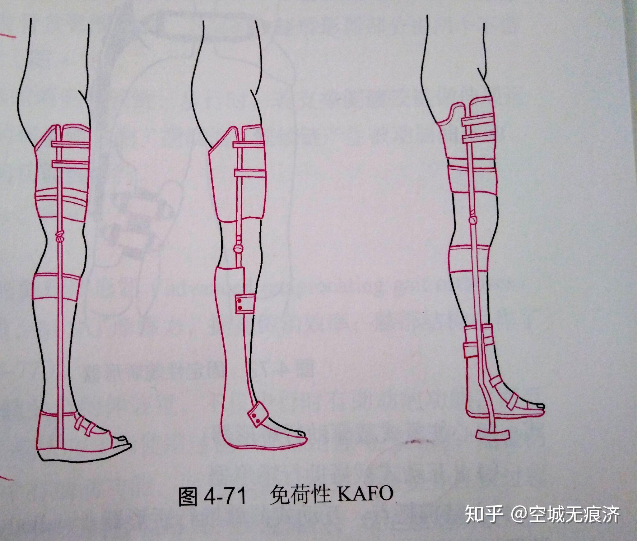臨床康復(fù)工程學(xué) 假肢與矯形器的功能、設(shè)計(jì)與發(fā)展